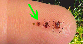 Why Tick Paralysis Is More Serious Than You Think